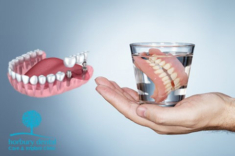 Why Choose Dental Implants Over Dentures?