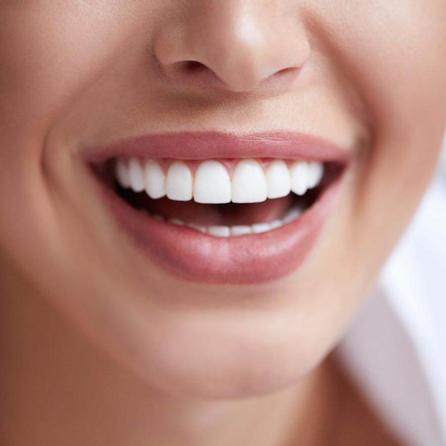 Teeth Whitening FAQs