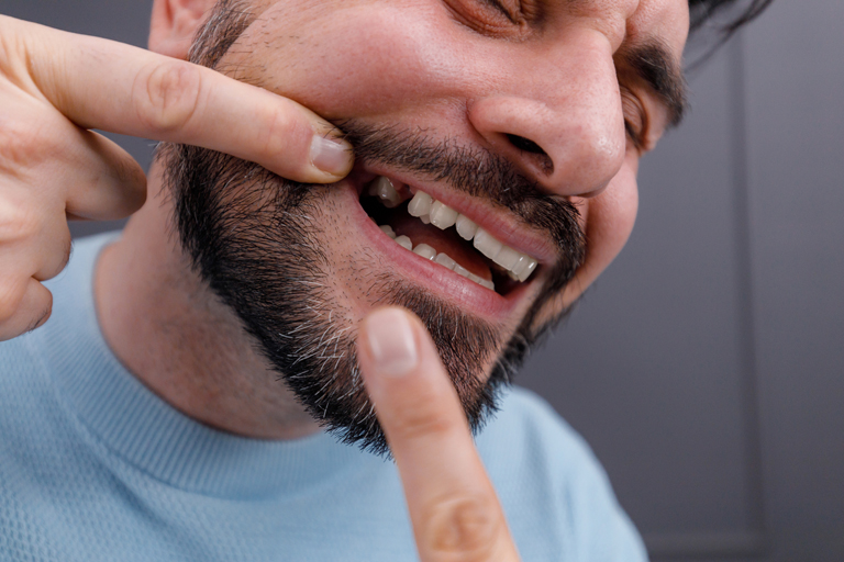 Best Solution for Missing Teeth