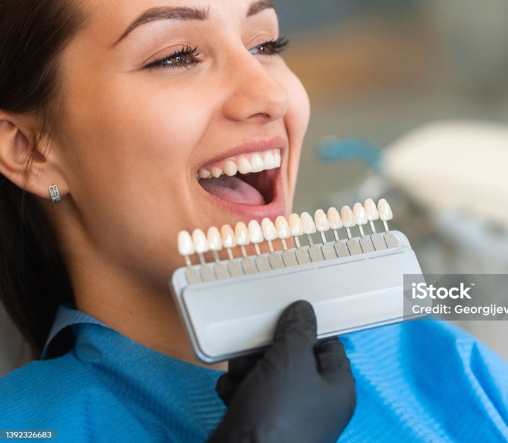 FAQs On Digital Smile Makeovers