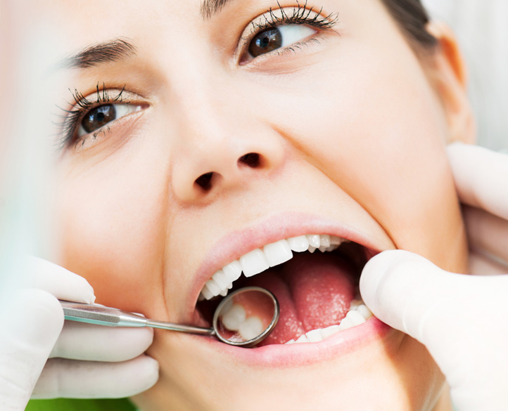 Frequently Asked Questions About White Fillings