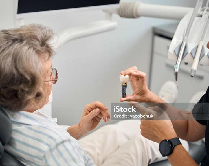 about single dental implants