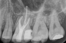 After Treatment