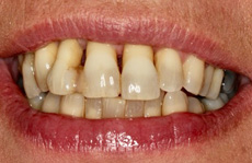 Before Treatment