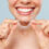 Your Complete Guide to Clear Aligners